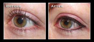Artistry Of Permanent Makeup - Before & After Gallery - Permanent Eyeliner