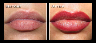 Artistry Of Permanent Makeup - Before & After Gallery - Permanent Lips