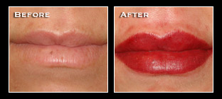 Artistry Of Permanent Makeup - Before & After Gallery - Permanent Lips