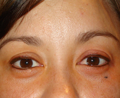 Eyebrows, Eyeliner, Lash Enhancement by Artistry Of Permanent Makeup of Orange County