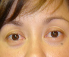 Permanent Eyeliner and Lash Enhancement by Artistry Of Permanent Makeup of Orange County