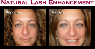 Artistry Of Permanent Makeup - Before & After Gallery - Natural Lash Enhancement